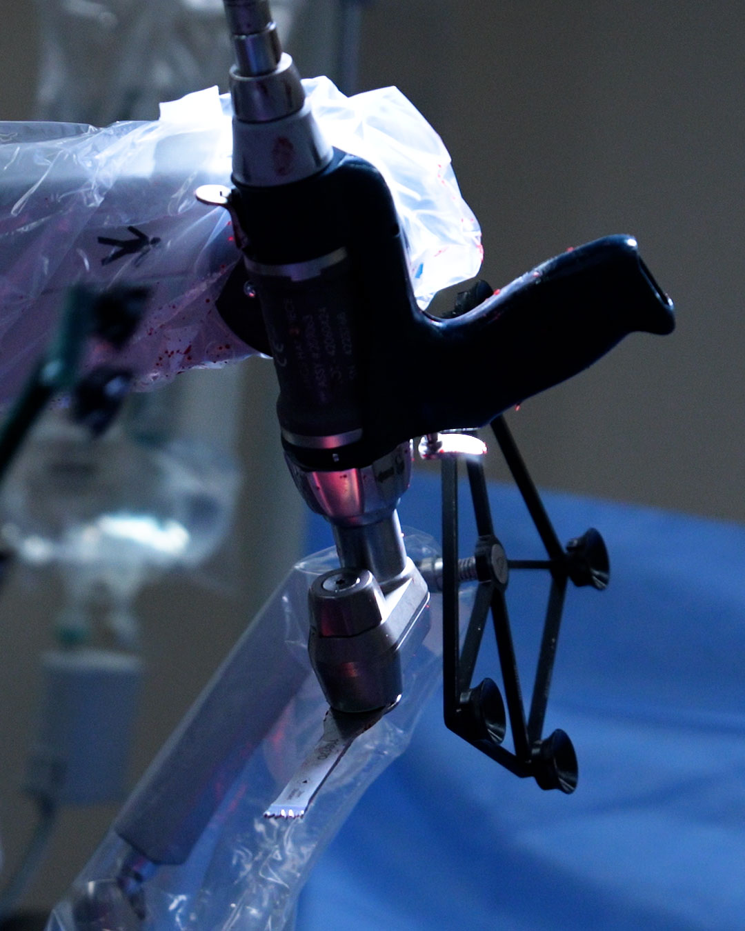 Dr.-Green-1000-Mako-Procedure_06